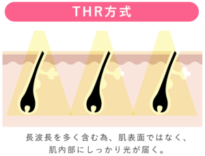 THR脱毛の仕組み