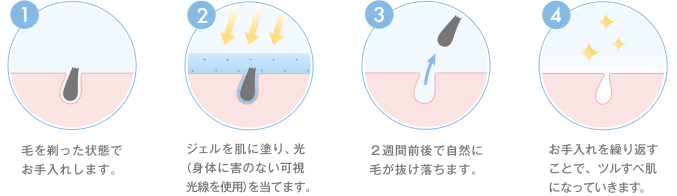 ミュゼプラチナムの脱毛方法