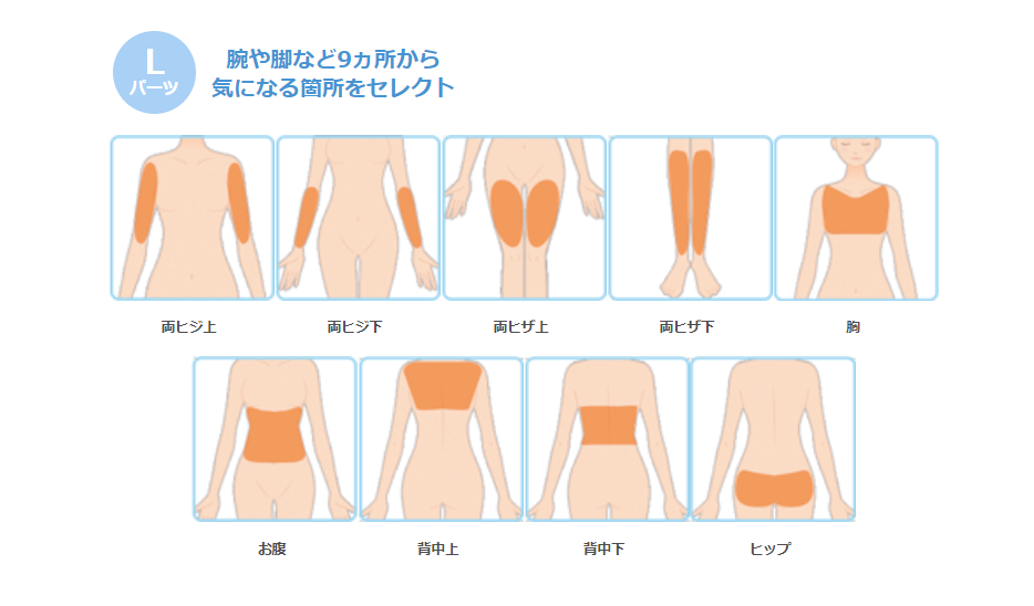 ミュゼプラチナムーフリーセレクトコースLパーツ