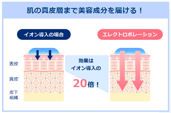 エレクトロポレーションとイオン導入の違い